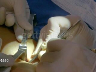 Aj укриття від wwe отримує її third груди implant: безкоштовно для дорослих кіно 8e