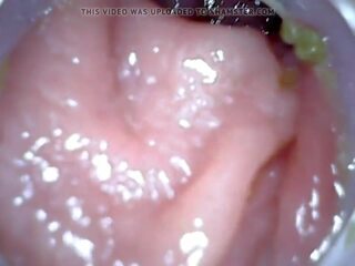항문의 endoscope 부분 1, 무료 관장 처벌 고화질 트리플 엑스 클립 04